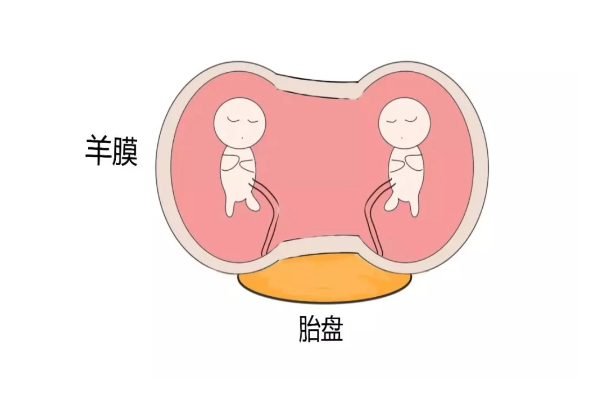 泰国三代试管婴儿助孕费用详解，预算规划与关键因素