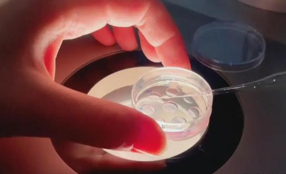 美国三代试管婴儿流程全解析，从促排到妊娠的每一步