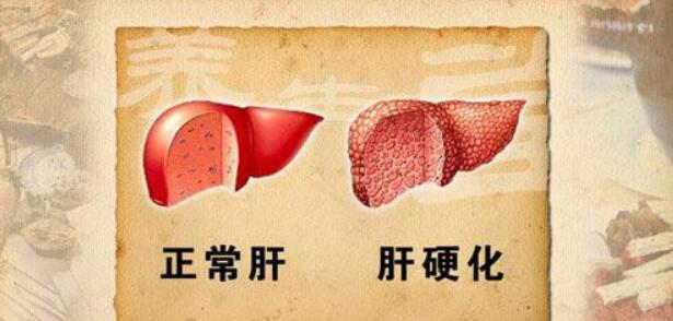 做试管婴儿前期检查中该如何判断精液是否正常？