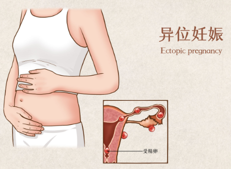 哈萨克斯坦试管婴儿成功率介绍！哈萨克斯坦试管婴儿怎么提高成功率？